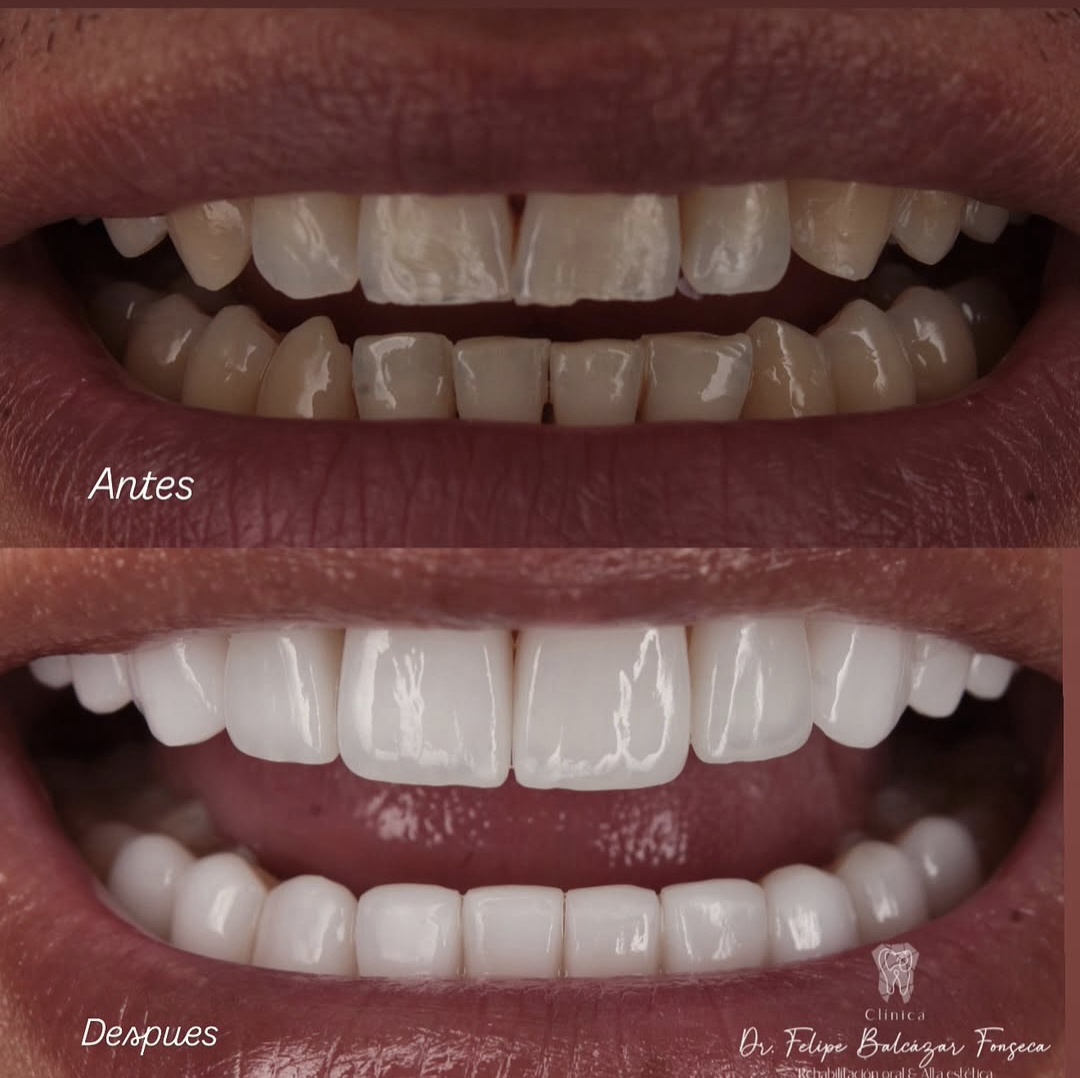 Alta Estética Dental
